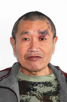 走失者照片 全国救助站