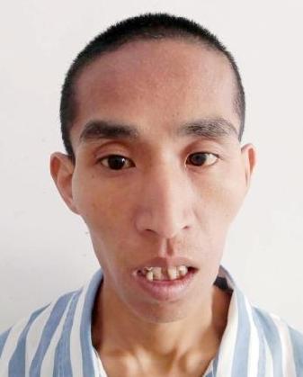 走失者照片 全国救助站