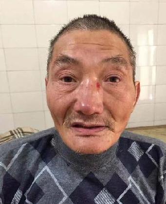 走失者照片 全国救助站