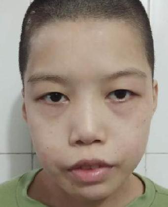 走失者照片 全国救助站