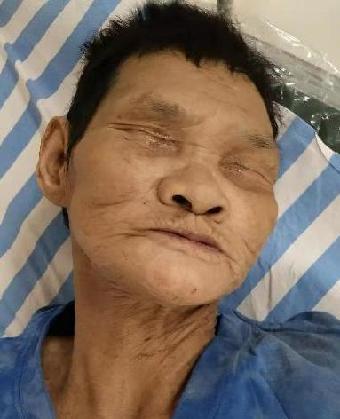 走失者照片 全国救助站