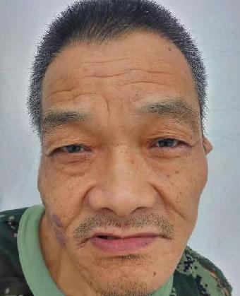 走失者照片 全国救助站