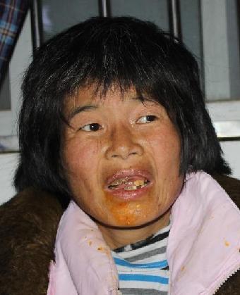 走失者照片 全国救助站