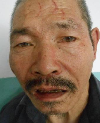 走失者照片 全国救助站