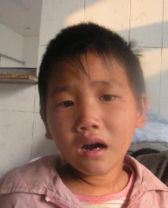 走失者照片 全国救助站