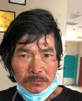 走失者照片 全国救助站