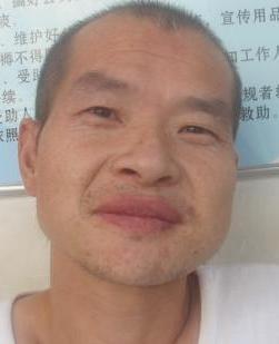 走失者照片 全国救助站