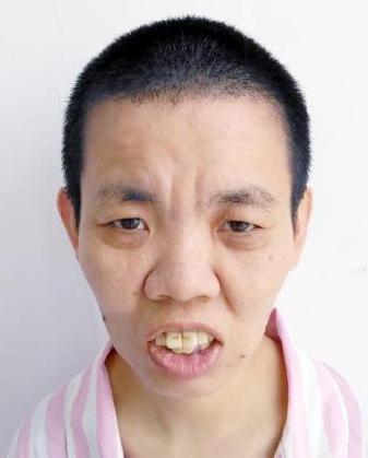 走失者照片 全国救助站