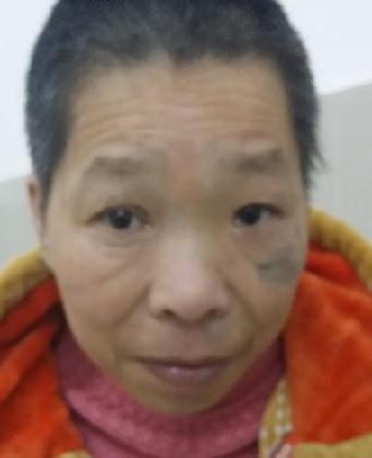 走失者照片 全国救助站
