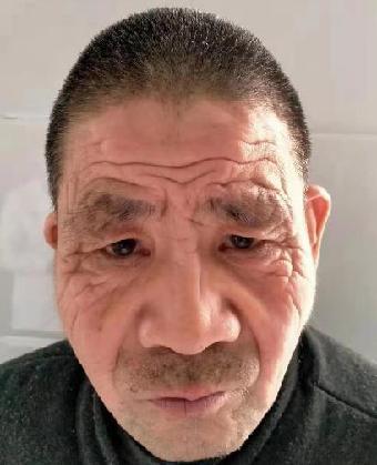 走失者照片 全国救助站
