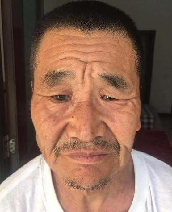 走失者照片 全国救助站