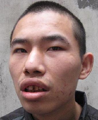 走失者照片 全国救助站
