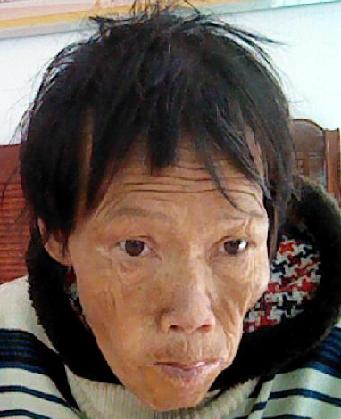走失者照片 全国救助站