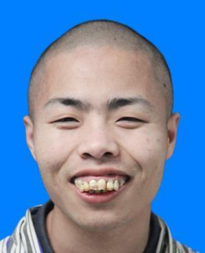 走失者照片 全国救助站
