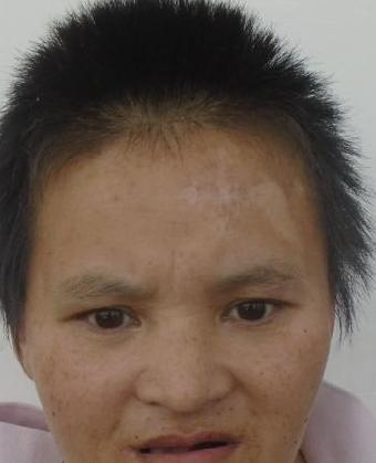 走失者照片 全国救助站