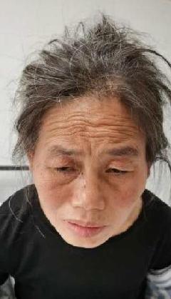 走失者照片 全国救助站