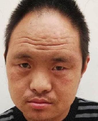 走失者照片 全国救助站