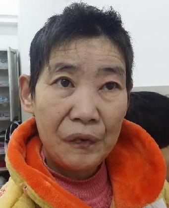 走失者照片 全国救助站