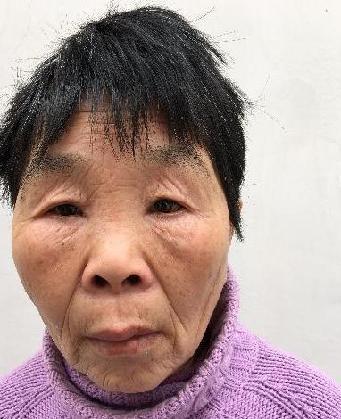 走失者照片 全国救助站