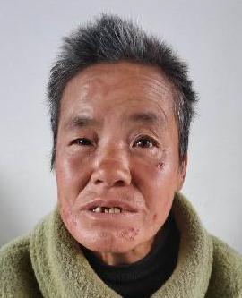 走失者照片 全国救助站