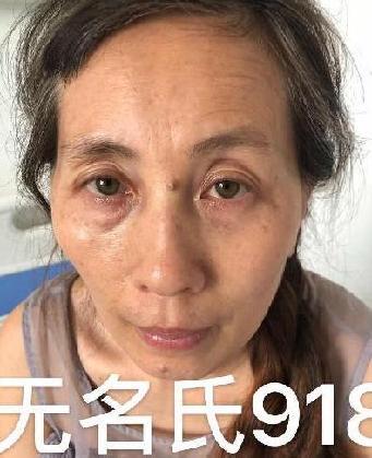 走失者照片 全国救助站