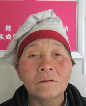走失者照片 全国救助站