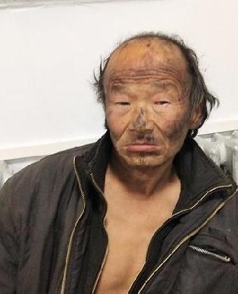 走失者照片 全国救助站