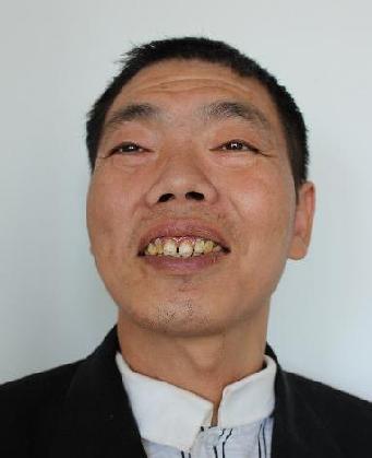 走失者照片 全国救助站