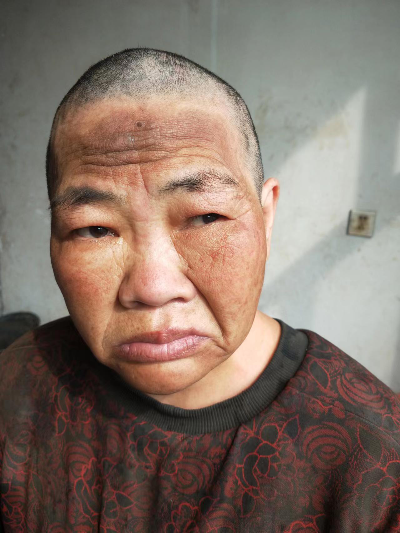 走失者照片 请大家帮助我母亲寻找家人