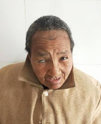 走失者照片 全国救助站
