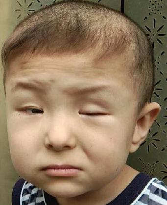 走失者照片 全国救助站