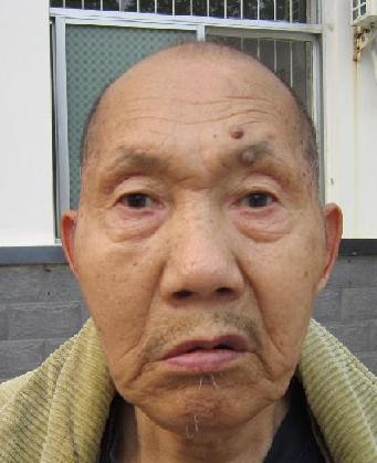 走失者照片 全国救助站