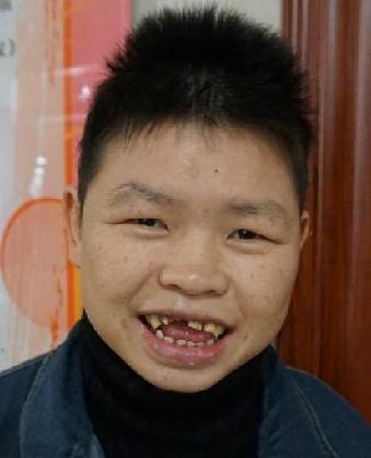 走失者照片 全国救助站