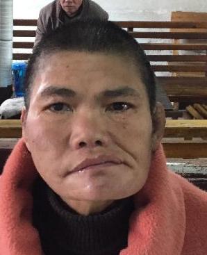 走失者照片 全国救助站