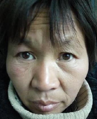 走失者照片 全国救助站