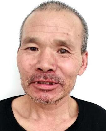 走失者照片 全国救助站