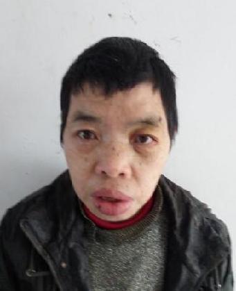 走失者照片 全国救助站