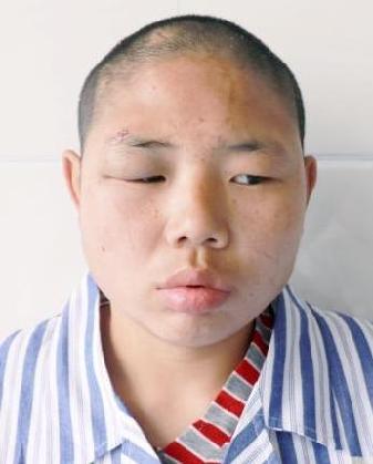 走失者照片 全国救助站