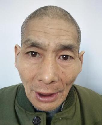 走失者照片 全国救助站
