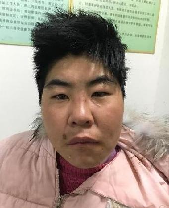 走失者照片 全国救助站
