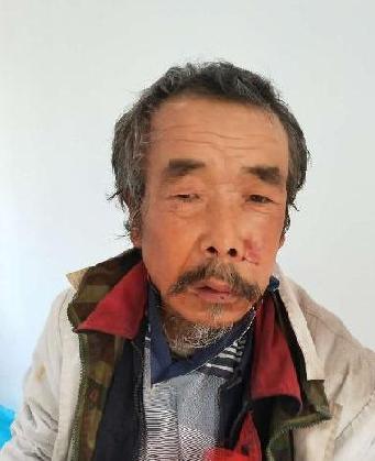 走失者照片 全国救助站