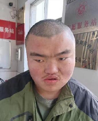 走失者照片 全国救助站