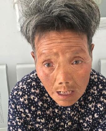 走失者照片 全国救助站
