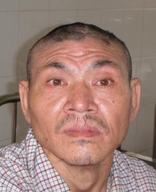 走失者照片 全国救助站