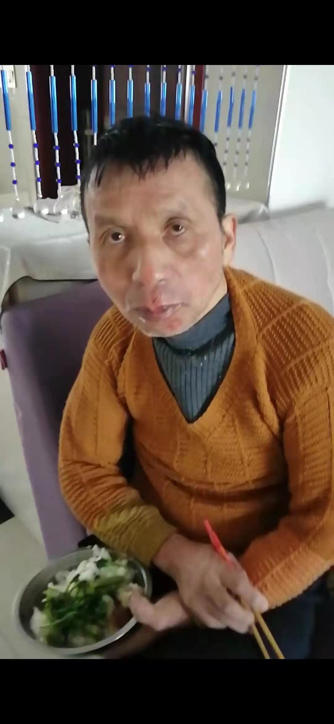 走失者照片 这个是我爸爸，在丰城个老乡帮忙留意...