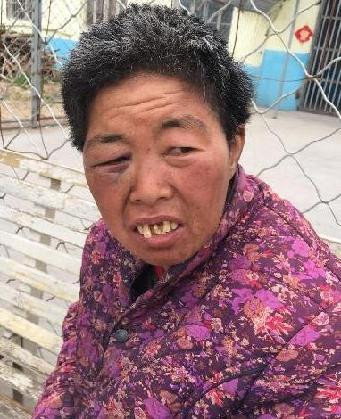 走失者照片 全国救助站
