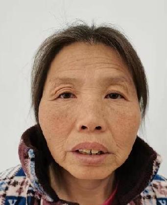 走失者照片 全国救助站