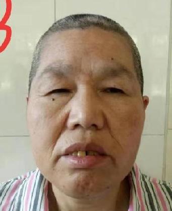 走失者照片 全国救助站
