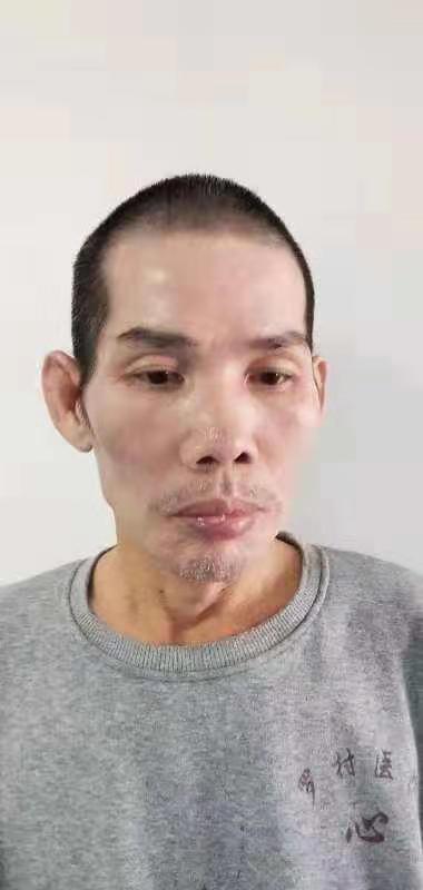走失者照片 全国救助站