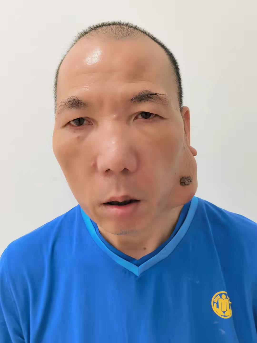 走失者照片 全国救助站